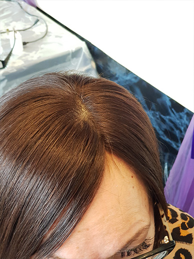 Women's Bespoke Hair Systems - Elite 9 Hair Clinic Nottingham